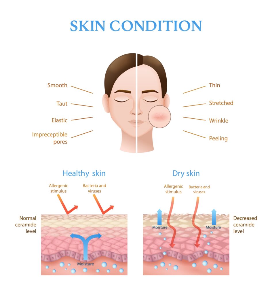 skin conditions